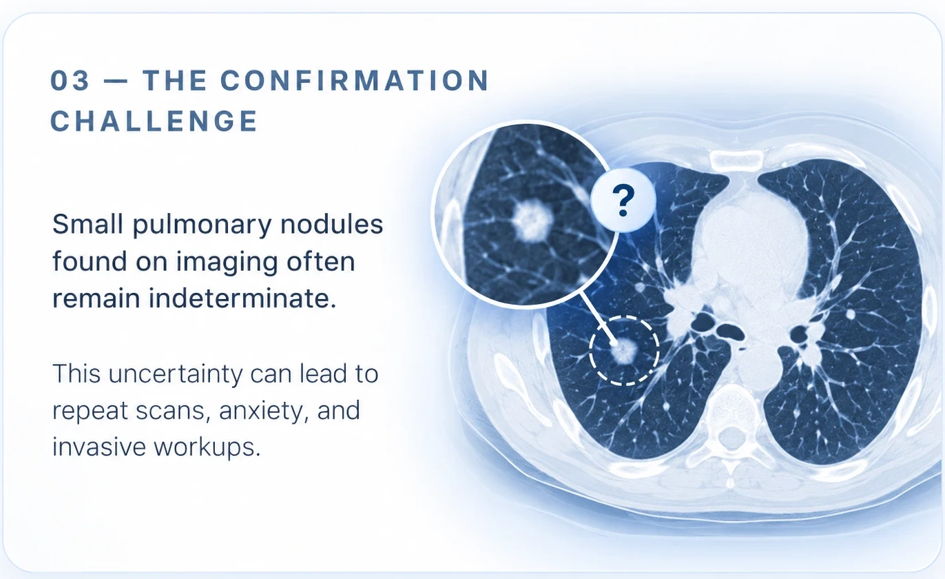 The confirmation challenge: small pulmonary nodules found on imaging often remain indeterminate, which can lead to repeat scans, anxiety and invasive diagnostic work-ups.