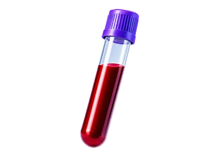 Blood sample tube